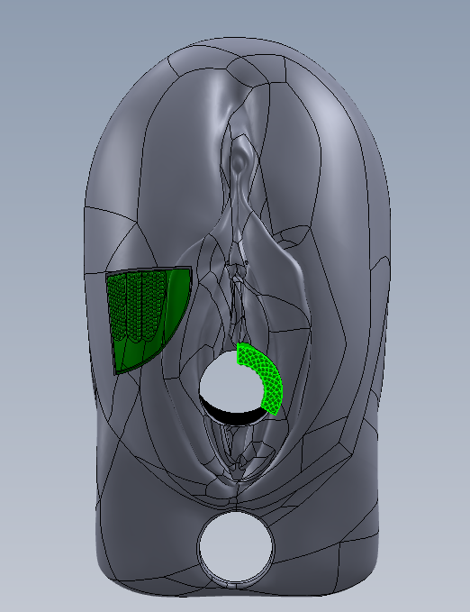FIGURE 1- Vulva with anus indication and 2 lesions.png